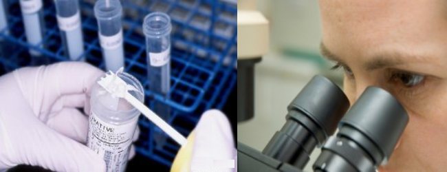 Анализ кала