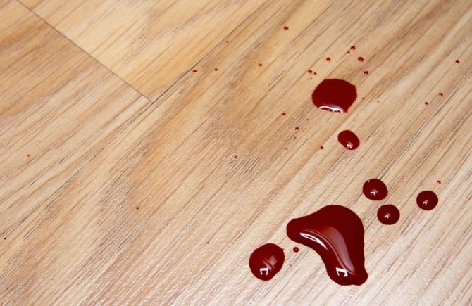 сильное кровотечение