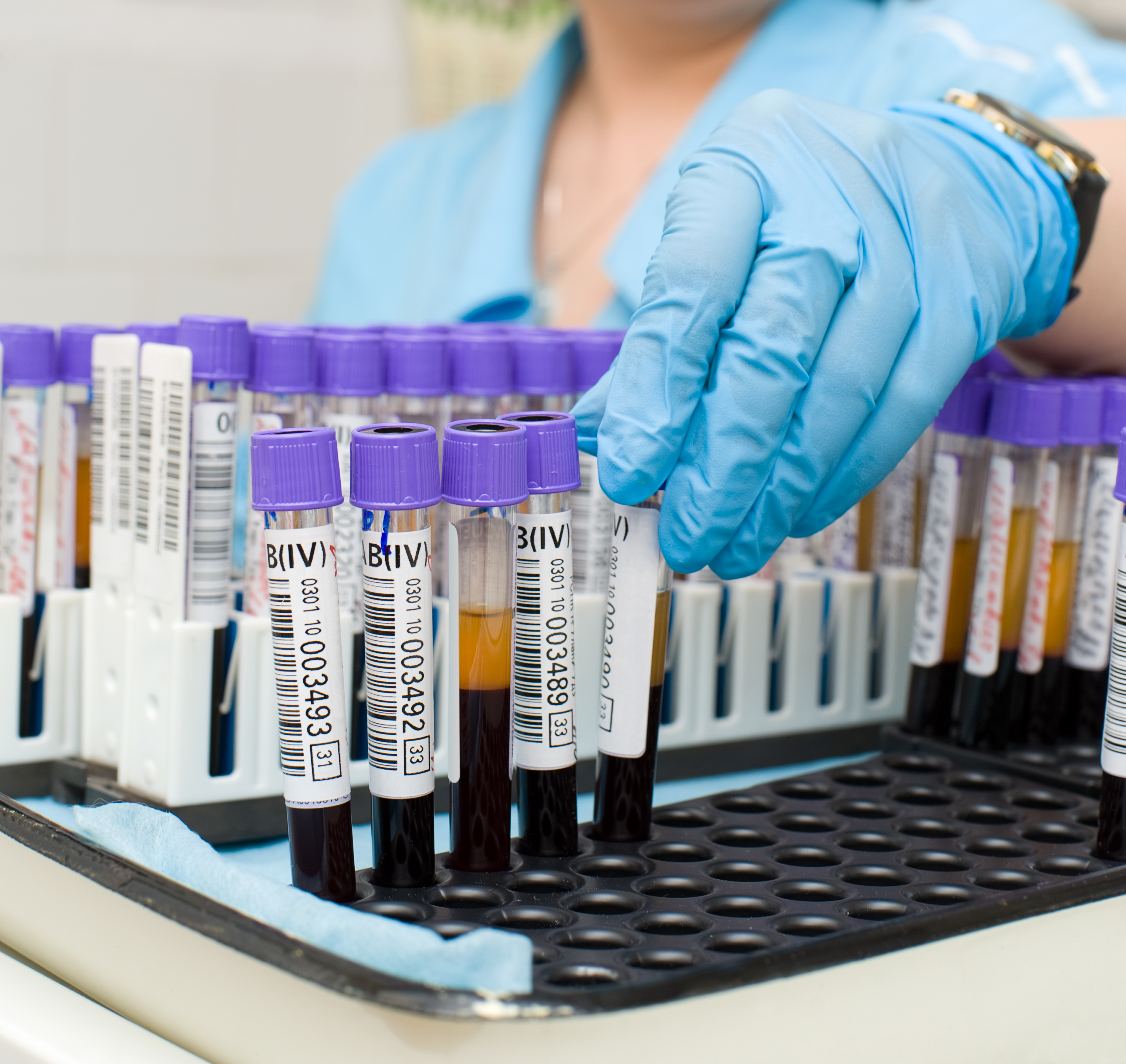 Токсоплазмоз при беременности