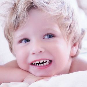 У малыша неправильный прикус Ребенок скрипит зубами во сне