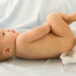 Мама выполняет гигиену девочке Белый налет на половых губах грудничка