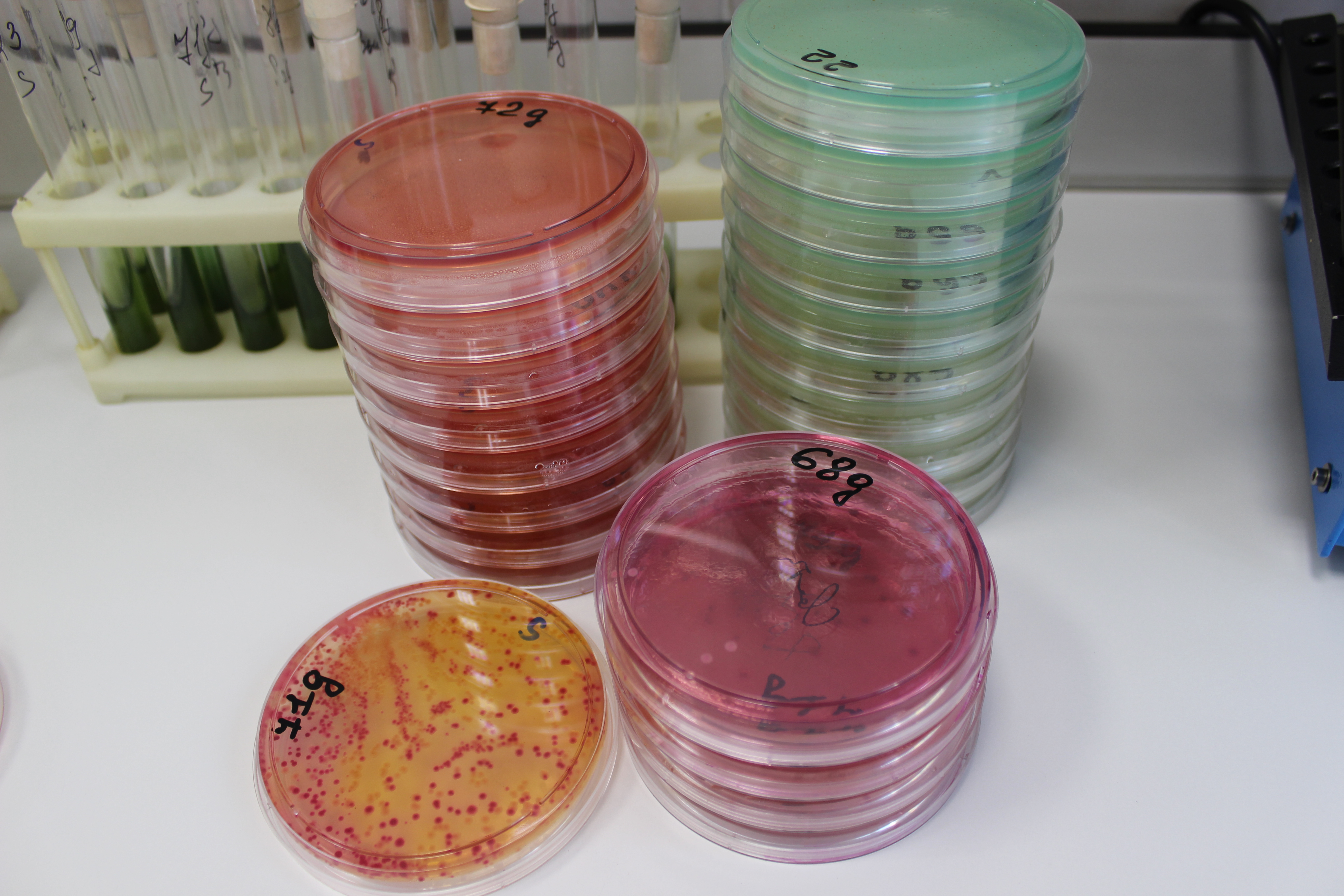 Свободный эстриол при беременности