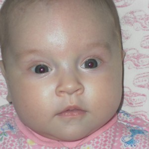 Малыш болен, вокруг рта посинело Синева вокруг рта у грудничка