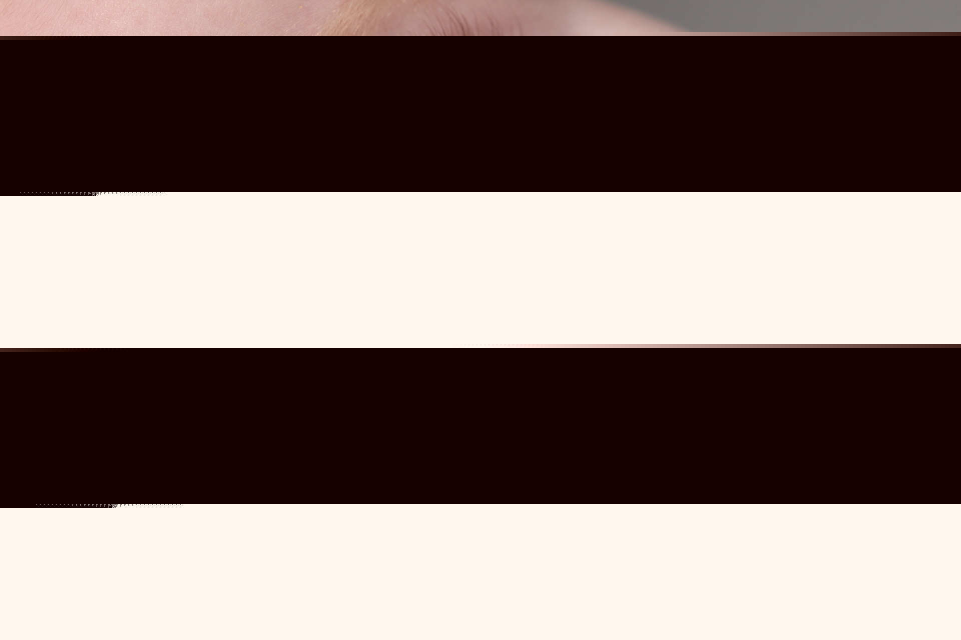 Гноятся глазки Дакриоцистит у новорожденных