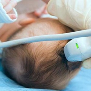 Для чего делают узи головного мозга грудничкам