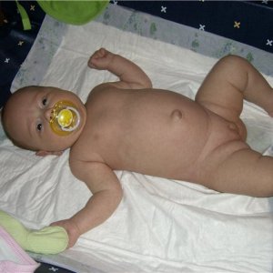 Почему у грудничка потемнел пупок