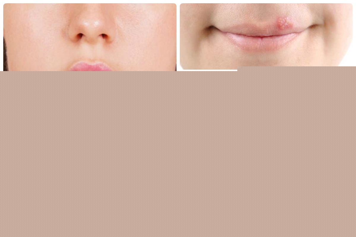 Цитомегаловирус при беременности