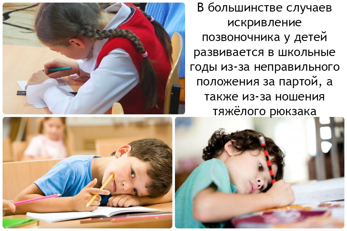 Причины Нарушение осанки у детей школьного возраста