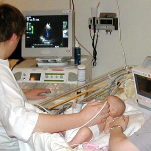 УЗИ головного мозга у грудничка где сделать