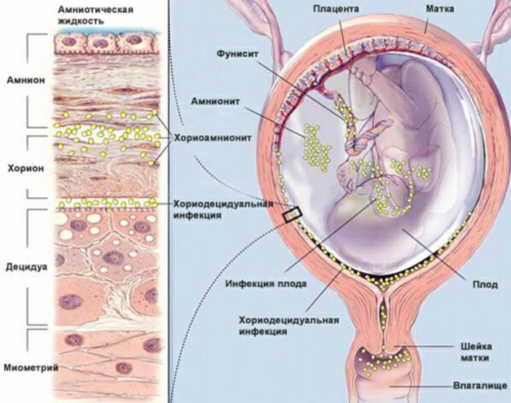 Цитомегаловирус при беременности