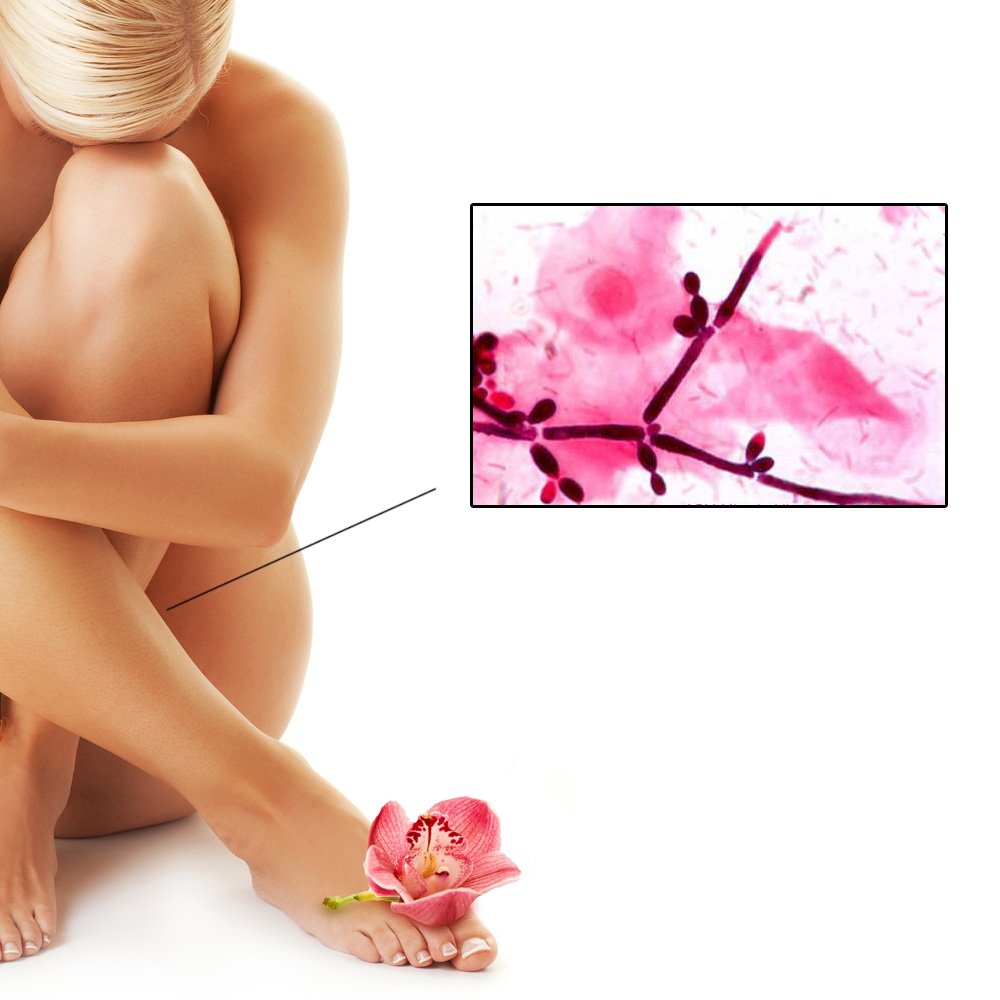 Цистит при беременности