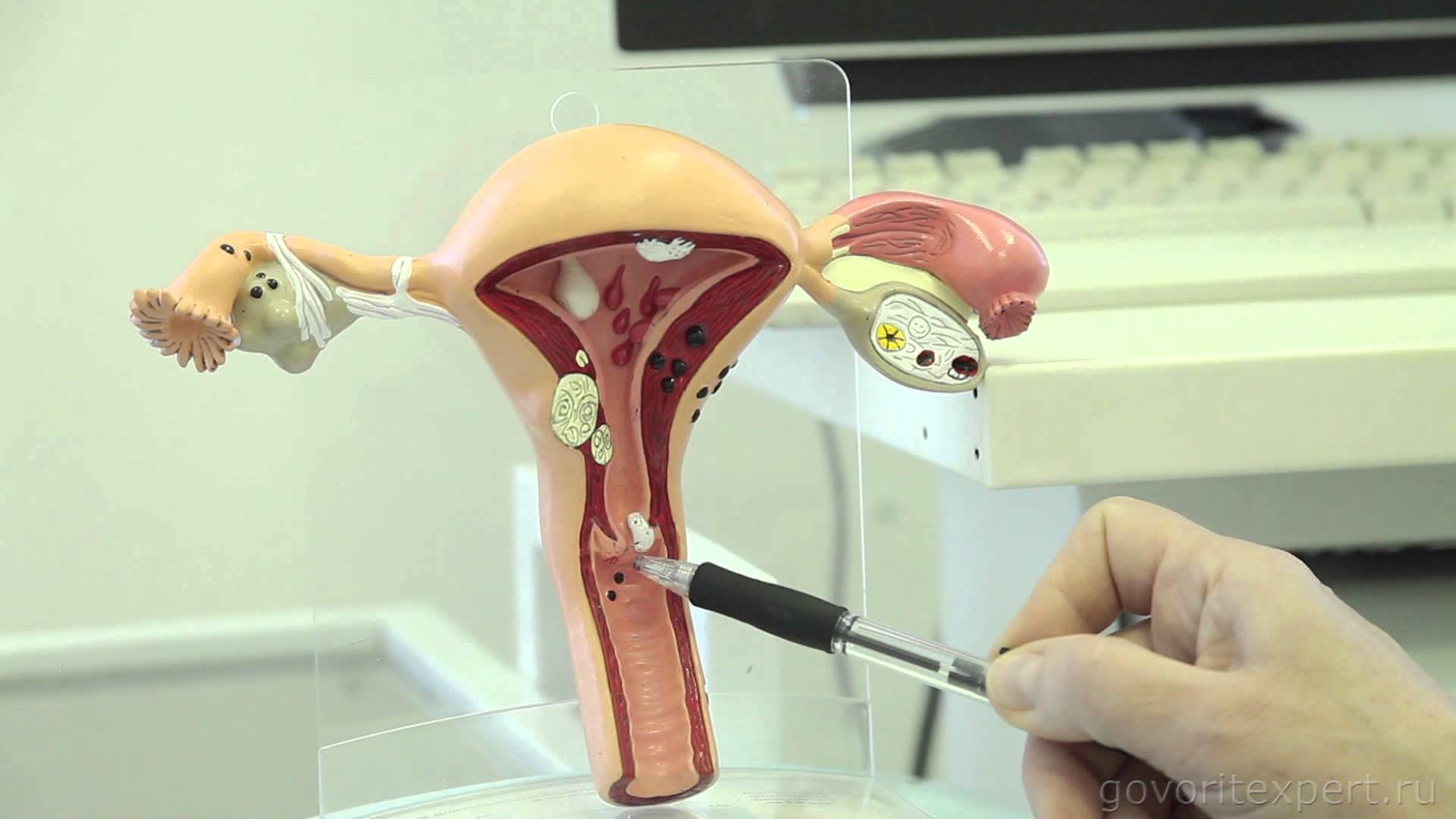 Механизм обследования Кольпоскопия при беременности