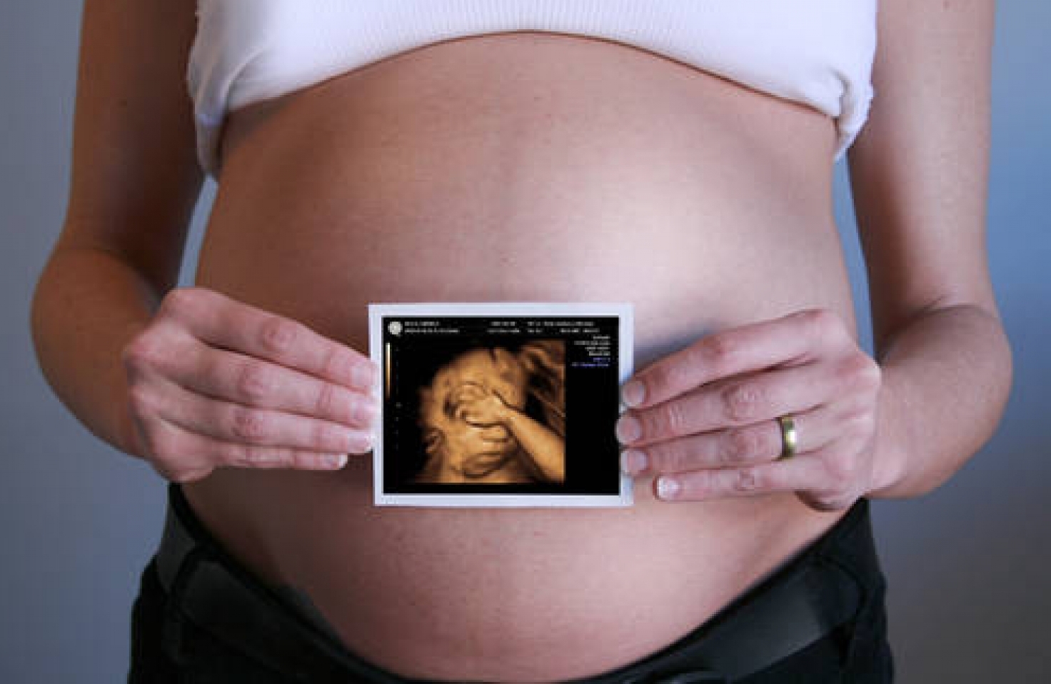 Результат УЗИ Гипотрофия плода