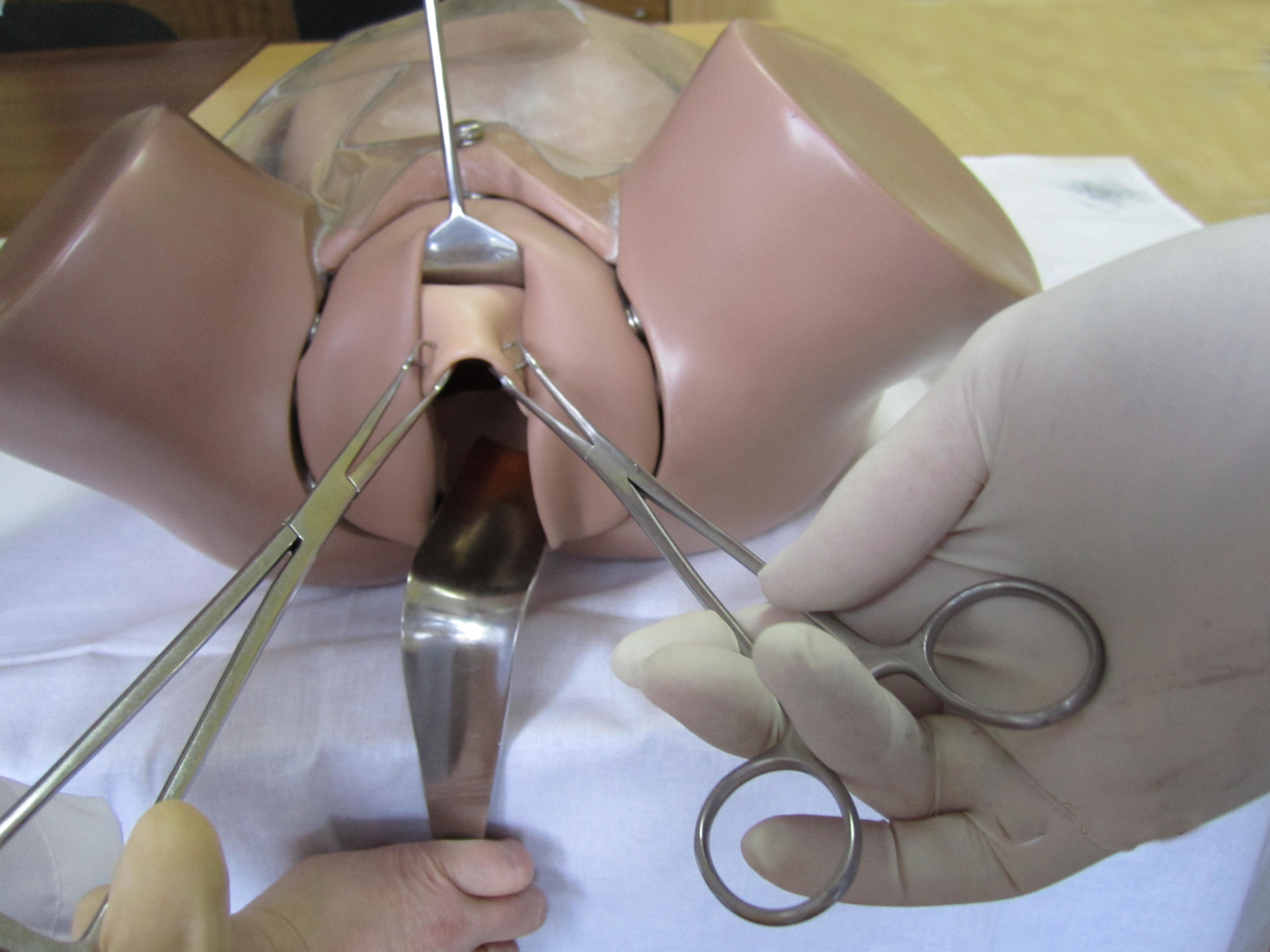 Так выполняется операция Короткая шейка матки при беременности