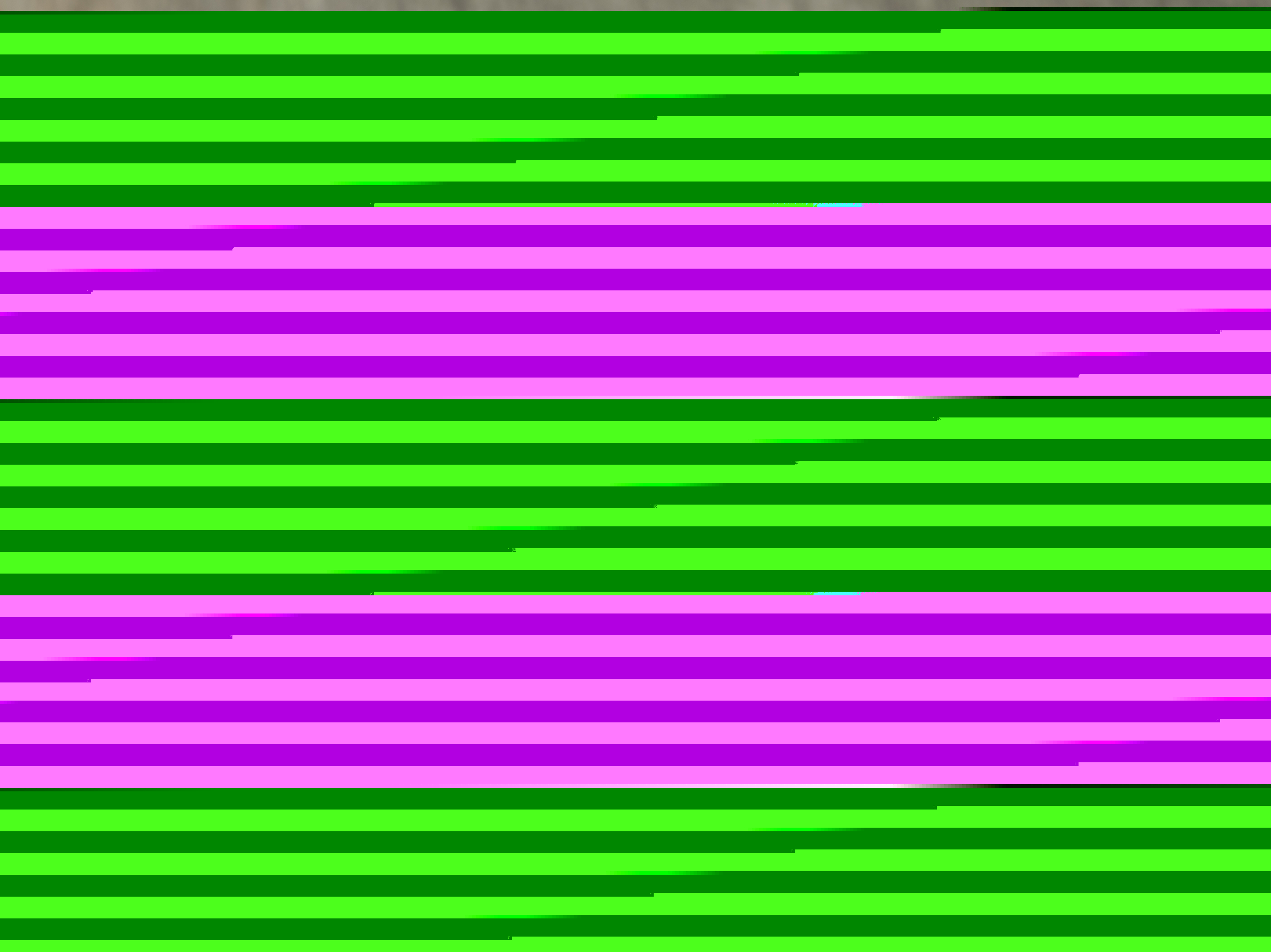 Геморрой при беременности