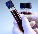 норма АЧТВ для беременных