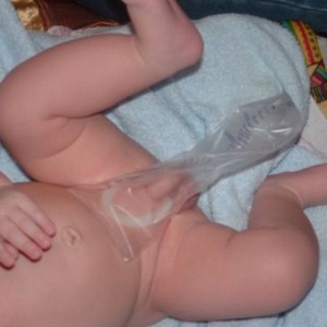 Сбор мочи у мальчика грудничка