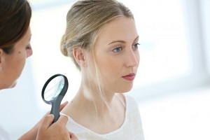 удаление бородавок