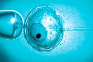 Экстракорпоральное оплодотворение что такое ЭКО