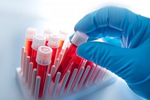 гематокрит при беременности гематокрит