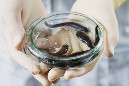 что такое гирудотерапия гирудотерапия