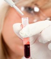 гомоцистеин