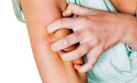 чешется кожа зуд кожи