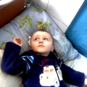 киста головного мозга Симптомы кисты головного мозга у ребенка