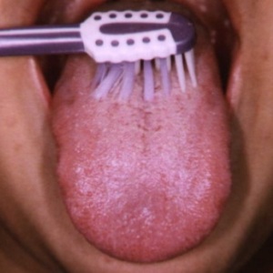 Гигиена рта