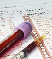 норма альфа-фетопротеина