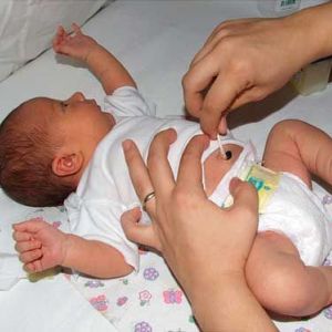 Домашние процедуры после усечения пупочной грыжи Лечение пупочной грыжи