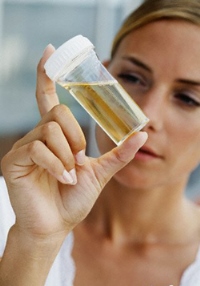 оксалаты в моче при беременности оксалаты в анализах мочи