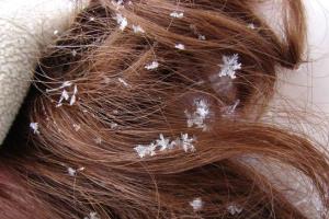 что такое перхоть