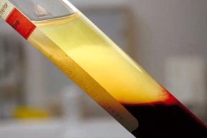 плазма крови