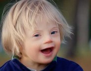 развитие у ребенка синдрома Дауна