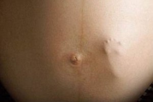 синяки на животе