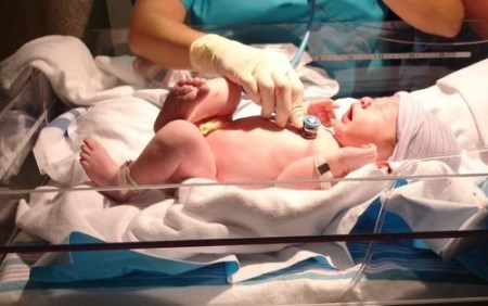 последствия вентрикуломегалии у плода  последствия вентрикуломегалии