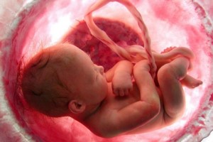 что такое взвеси в водах взвеси в околоплодных водах