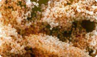 Бактерии золотистого стафилококка